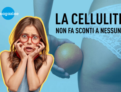 La cellulite non fa sconti a nessuno